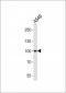 ZNF287 Antibody (N-term)